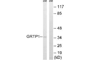 Western blot analysis of extracts from 293 cells, using GRTP1 antibody. (GRTP1 anticorps  (Internal Region))