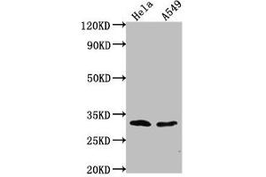 Western Blot Positive WB detected in: Hela whole cell lysate, A549 whole cell lysate All lanes: VAX2 antibody at 1:2000 Secondary Goat polyclonal to rabbit IgG at 1/50000 dilution Predicted band size: 31 kDa Observed band size: 31 kDa (VAX2 anticorps  (AA 1-74))