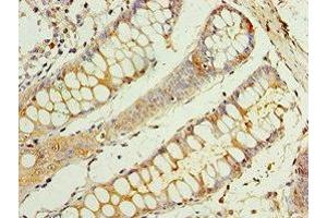 Immunohistochemistry of paraffin-embedded human colon tissue using ABIN7146811 at dilution of 1:100 (CEACAM8 anticorps  (AA 35-320))