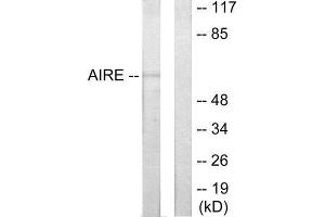 Western Blotting (WB) image for anti-Autoimmune Regulator (AIRE) (Internal Region) antibody (ABIN6299495) (AIRE anticorps  (Internal Region))