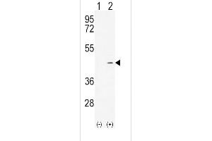 Western blot analysis of ADH4 (arrow) using rabbit polyclonal ADH4 Antibody (C-term) (ABIN654087 and ABIN2843975).