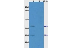 Lane 1: rat brain lysates Lane 2: rat liver lysates probed with Anti CD161 Polyclonal Antibody, Unconjugated (ABIN680998) at 1:200 in 4 °C.