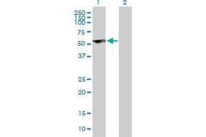 Western Blot analysis of ZNF232 expression in transfected 293T cell line by ZNF232 MaxPab polyclonal antibody. (ZNF232 anticorps  (AA 1-444))