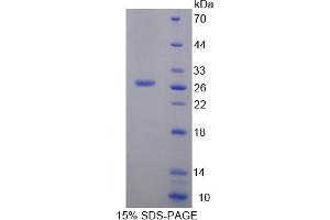 Image no. 1 for Prolyl 4-Hydroxylase, beta Polypeptide (P4HB) (AA 309-525) protein (His tag) (ABIN6236752) (P4HB Protein (AA 309-525) (His tag))