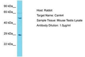 Image no. 1 for anti-Calcium/calmodulin-Dependent Protein Kinase IV (CAMK4) (AA 363-412) antibody (ABIN6750255) (CAMK4 anticorps  (AA 363-412))