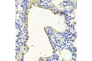 Immunohistochemistry of paraffin-embedded mouse lung using PKN1 antibody.