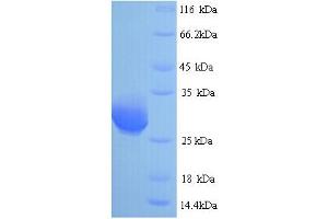 SDS-PAGE (SDS) image for RAB3A Interacting Protein (Rabin3)-Like 1 (RAB3IL1) (AA 21-247) protein (His tag) (ABIN5713494)