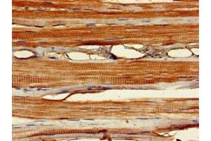 Immunohistochemistry of paraffin-embedded human skeletal muscle tissue using ABIN7160518 at dilution of 1:100 (MYF6 anticorps  (AA 26-232))