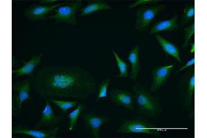 Immunofluorescence of purified MaxPab antibody to PRKD1 on HeLa cell.