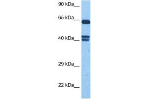 Host:  Rabbit  Target Name:  FZD10  Sample Tissue:  Human MCF7 Whole Cell  Antibody Dilution:  1ug/ml (FZD10 anticorps)