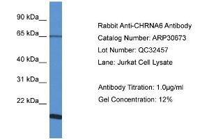 WB Suggested Anti-CHRNA6 Antibody   Titration: 1. (CHRNA6 anticorps  (N-Term))