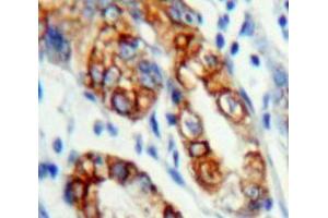 Used in DAB staining on fromalin fixed paraffin-embedded Stomach tissue (KLRC2 anticorps  (AA 19-190))