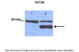 Lanes:   Lane 1: 25 ug empty vector transfected H460 cell lysate Lane 2: 25 ug hGATA5 transfected H460 cell lysate  Primary Antibody Dilution:   1:1200  Secondary Antibody:   Anti-rabbit HRP  Secondary Antibody Dilution:   1:3500  Gene Name:   GATA5  Submitted by:   Anonymous