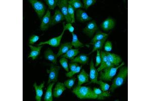 IF analysis of EIF5A using anti-EIF5A antibody (ABIN7599674). (EIF5A anticorps  (AA 107-154))