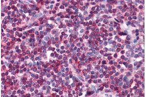 Human Tonsil: Formalin-Fixed, Paraffin-Embedded (FFPE) (SELPLG anticorps)