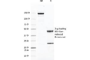 SDS-PAGE Analysis Purified CD46 Mouse Monoclonal Antibody (169-1-E4. (CD46 anticorps)
