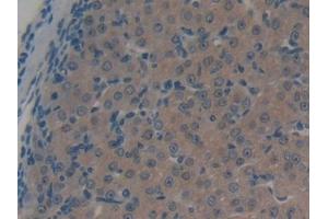 DAB staining on IHC-P; Samples: Mouse Ovary Tissue (ABCC1 anticorps  (AA 1219-1469))