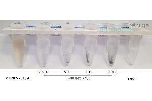 10 μL Magnetic ConA Beads (Agarose) ABIN6952467 at the indicated concentrations were loaded with 2x10^5 K562 cells as described in the protocol section and placed on a magnet stand.
