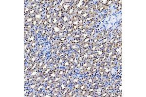 IHC analysis of SF3A1 using anti-SF3A1 antibody (ABIN7600556). (SF3A1 anticorps  (AA 20-556))
