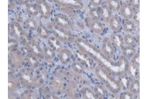 DAB staining on IHC-P; Samples: Rat Kidney Tissue