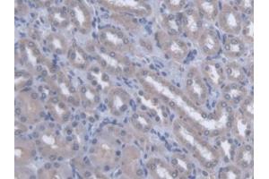 DAB staining on IHC-P; Samples: Rat Kidney Tissue (OSTM1 anticorps  (AA 124-277))
