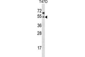 ZDHHC6 Antibody (C-term) western blot analysis in T47D cell line lysates (35 µg/lane). (ZDHHC6 anticorps  (C-Term))