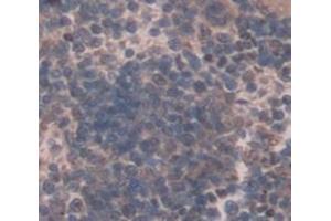 Used in DAB staining on fromalin fixed paraffin- embedded Kidney tissue (Osteocrin anticorps  (AA 26-130))