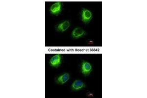 ICC/IF Image Immunofluorescence analysis of methanol-fixed HeLa, using INPP5F, antibody at 1:200 dilution. (INPP5F anticorps)