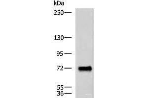 Western blot analysis of Human fetal brain tissue lysate using PPEF1 Polyclonal Antibody at dilution of 1:1500 (PPEF1 anticorps)