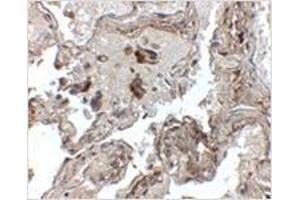 Immunohistochemistry of Transthyretin in human lung tissue with Transthyretin antibody at 2.