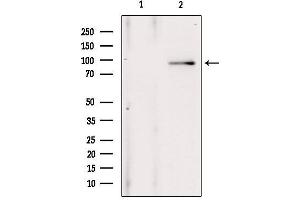 Western blot analysis of extracts from 293, using ANO1 Antibody. (ANO1 anticorps  (Internal Region))