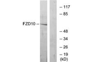 Western blot analysis of extracts from COS7 cells, using FZD10 Antibody. (FZD10 anticorps  (AA 135-184))