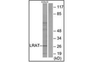 Western blot analysis of extracts from COLO205 cells, using LRAT Antibody . (LRAT anticorps  (Internal Region))