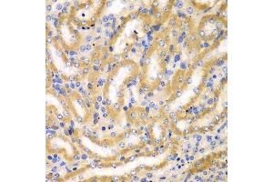 Immunohistochemistry of paraffin-embedded mouse kidney using BCAS3 antibody.