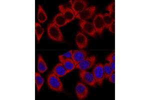 Confocal immunofluorescence analysis of HeLa cells using RPL36AL Polyclonal Antibody (ABIN7270007) at dilution of 1:100.