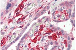 Human Placenta (formalin-fixed, paraffin-embedded) stained with AIF1 antibody ABIN337130 at 2. (Iba1 anticorps  (AA 138-148))