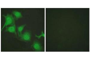 Immunofluorescence analysis of HuvEc cells, using NFE2L2 antibody (ABIN5976469). (NRF2 anticorps  (C-Term))
