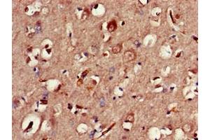 Immunohistochemistry of paraffin-embedded human brain tissue using ABIN7147793 at dilution of 1:100 (CLOCK anticorps  (AA 577-846))