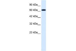 WB Suggested Anti-TRIM9 Antibody Titration:  0. (TRIM9 anticorps  (C-Term))