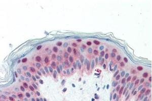 Human Skin: Formalin-Fixed, Paraffin-Embedded (FFPE)
