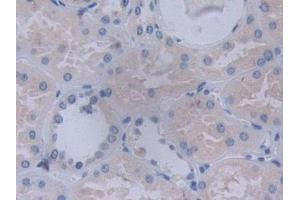 Detection of YARS in Human Kidney Tissue using Polyclonal Antibody to Tyrosyl tRNA Synthetase (YARS)
