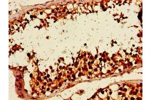 Immunohistochemistry of paraffin-embedded human testis tissue using ABIN7154943 at dilution of 1:100 (HLTF anticorps  (AA 332-476))