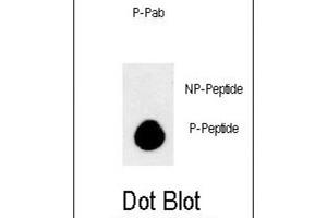 Dot Blot (DB) image for anti-APG8b (pThr93), (pTyr99) antibody (ABIN3001933) (APG8b (pThr93), (pTyr99) anticorps)