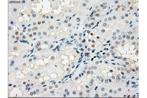 Immunohistochemical staining of paraffin-embedded Kidney tissue using anti-GBP2mouse monoclonal antibody. (GBP2 anticorps)