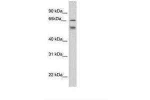 Image no. 1 for anti-Epithelial Splicing Regulatory Protein 2 (ESRP2) (AA 61-110) antibody (ABIN202881) (ESRP2 anticorps  (AA 61-110))