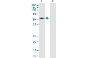 Western Blot analysis of S100PBP expression in transfected 293T cell line by S100PBP MaxPab polyclonal antibody. (S100PBP anticorps  (AA 1-408))