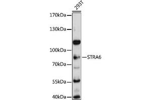 Western blot analysis of extracts of 293T cells, using STR antibody (ABIN6133187, ABIN6148633, ABIN6148634 and ABIN6215704) at 1:3000 dilution. (STRA6 anticorps  (AA 538-667))