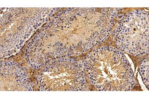 Detection of a1AT in Mouse Testis Tissue using Polyclonal Antibody to Alpha-1-Antitrypsin (a1AT)