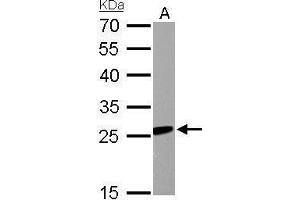 WB Image RGS2 antibody detects RGS2 protein by Western blot analysis. (RGS2 anticorps)