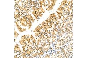 Immunohistochemistry analysis of paraffin-embedded mouse colon using LI Cadherin (ABIN7074493) at dilution of 1: 1500 (LI Cadherin anticorps)